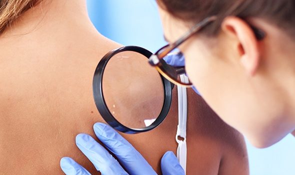 Dermatologist Checking A Patient's Skin