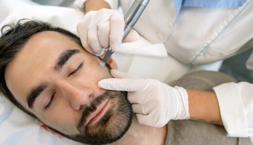 Dermatologist Performing Microneedling Treatment On Male Patient