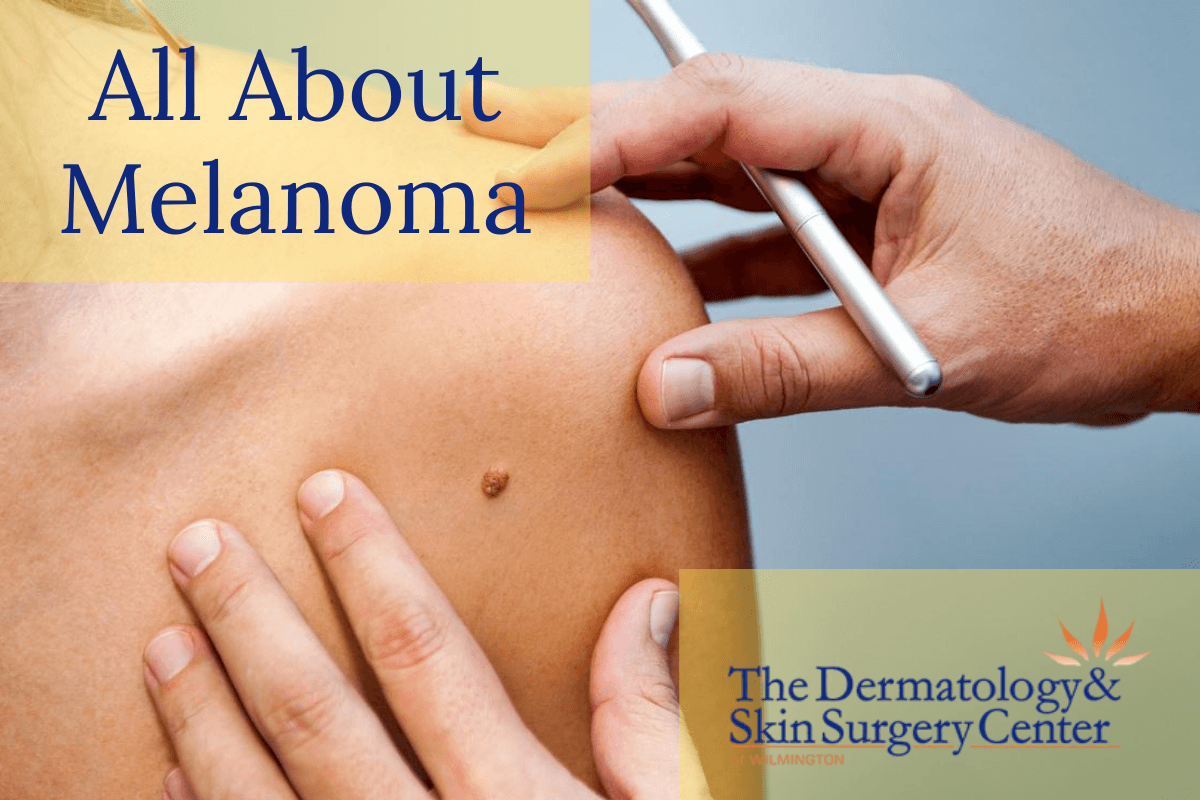 Learn About Melanoma Skin Cancer Warning Signs