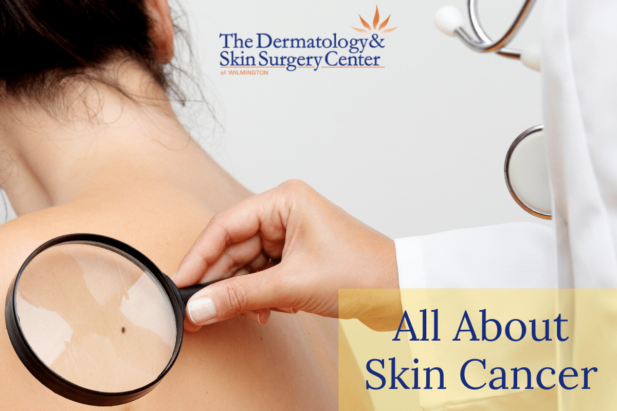Woman With Irregular Mole And A Dermatologist At The Dermatology & Skin Surgery Center Of Wilmington Evaluating Her Skin For Skin Cancer