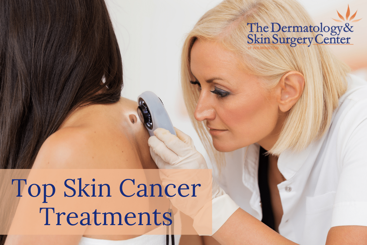 Top Skin Cancer Treatments At The Dermatology & Skin Surgery Center Of Wilmington
