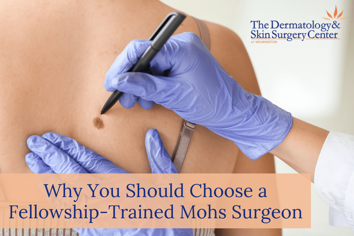 Why You Should Choose A Fellowship-trained Mohs Surgeon At The Dermatology & Skin Surgery Center Of Wilmington