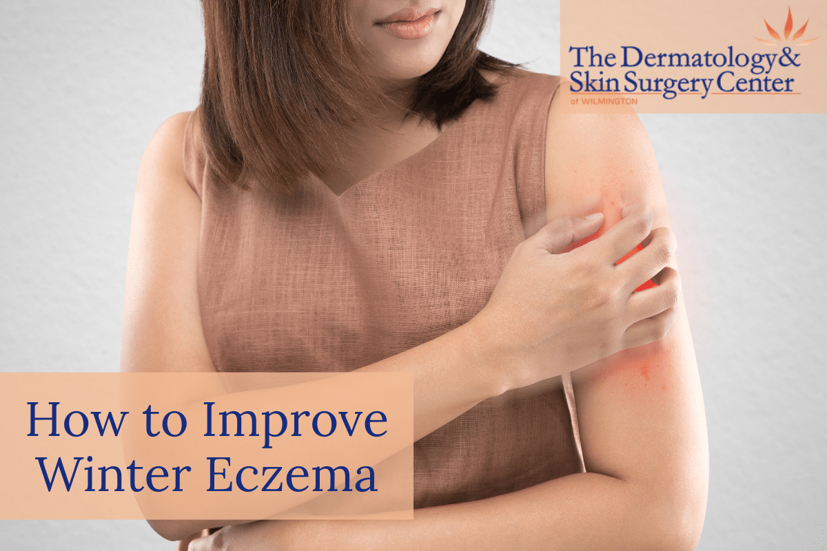 Woman With Winter Eczema | How To Improve Winter Eczema With Tips From The Dermatology & Skin Surgery Center Of Wilmington